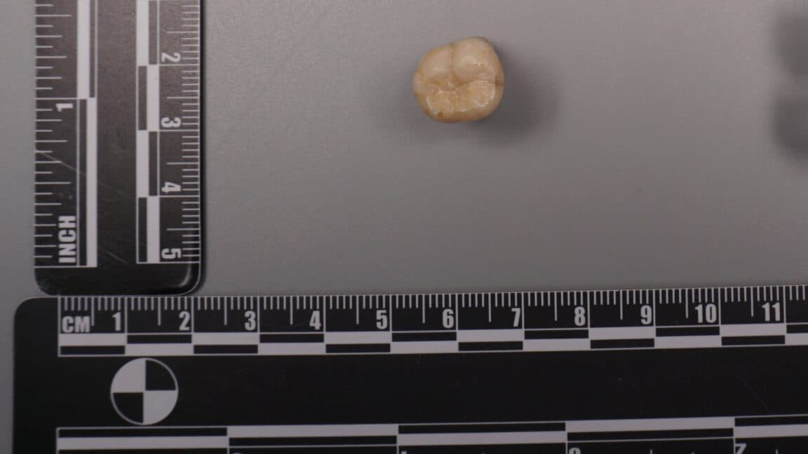 Homo erectus dişlerindeki protein, Denisovalıların bize DNA'larının bir kısmını verdiğini gösteriyor