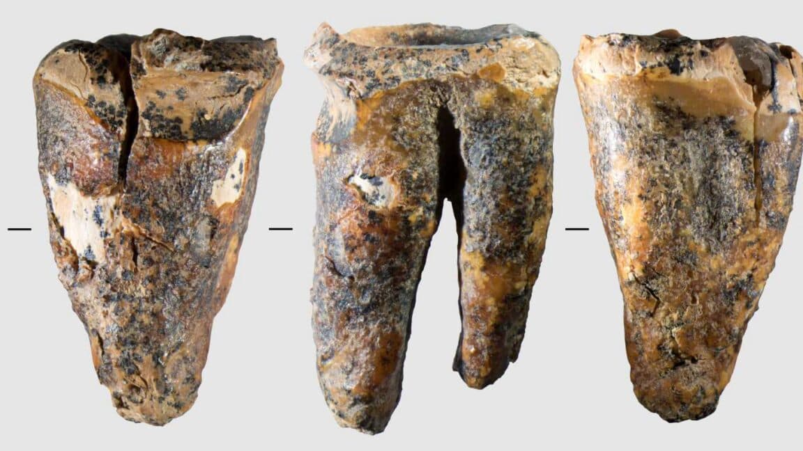 Neandertaller 59.000 yıl önce diş ağrısını tedavi etmek için oyuklar açıyordu