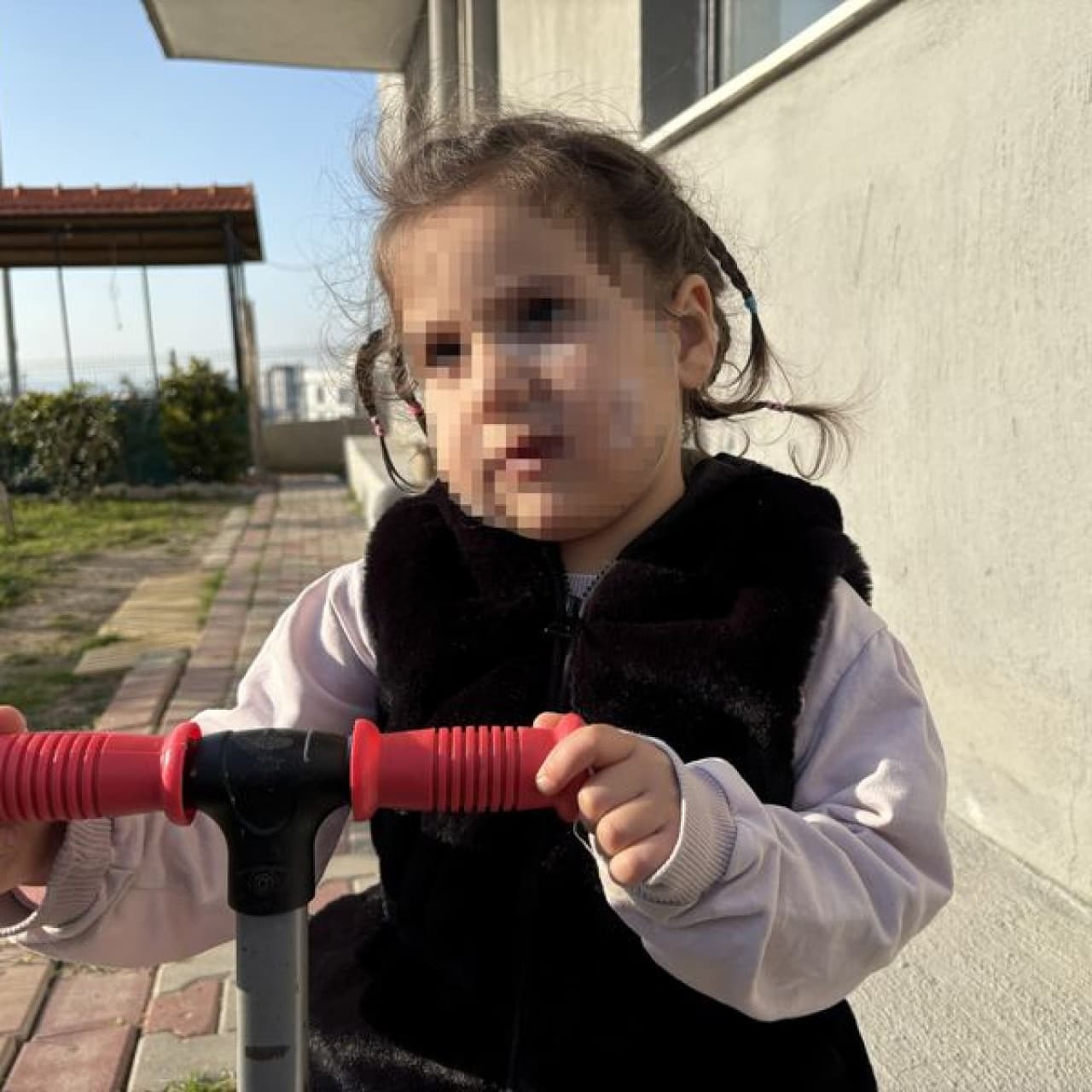 3 yaşındaki çocuk köpek saldırısına uğradı 