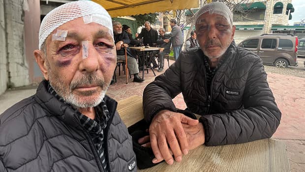 Önce çakmak istediler ardından sokak ortasında darbettiler