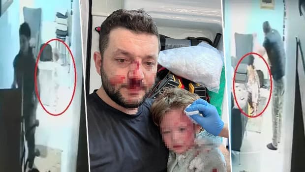 Baba ile 14 aylık kızının darbedilmesine ilişkin iddianame hazırlandı! Çocuk skuter'ı 'silah' olarak sayıldı... İşte istenen ceza