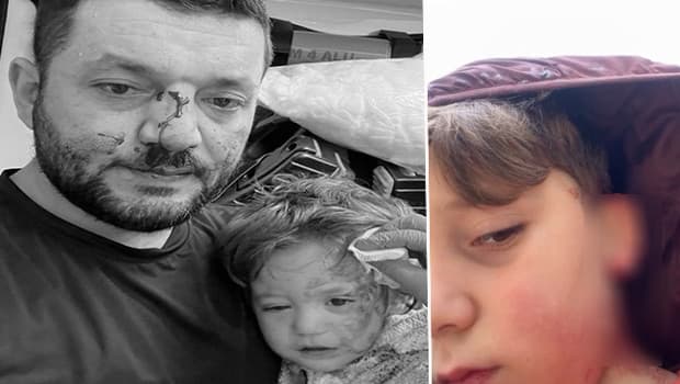 Kucağında 14 aylık bebeğiyle darbedilmişti: Bu kez de oğlu yaralandı! 'Tehditler alıyoruz, evimi satışa çıkardım'