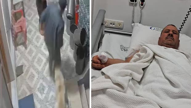 Korkunç olay kamerada: Köpeğin saldırısında koptu, doktorlar yerine dikemedi
