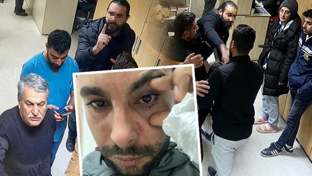Doktordan hastaya yumruklu saldırı iddiası: Yüzde 30 görme kaybı oluştu | 'Düşmanına vurur gibi yumruk atıyor'