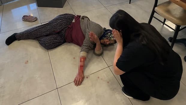 Afyonkarahisar'da köpek saldırısında kadının kolu koptu