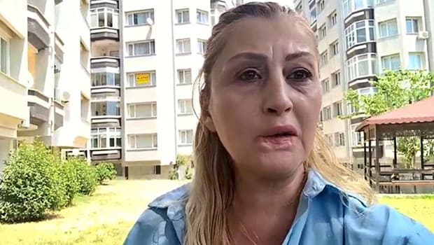 Antalya'da estetik kabusu! Dudağını kaybeden kadının 7 yıllık hukuk mücadelesi sürüyor