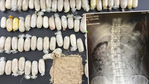 Şüphe üzerine durduruldular: 2 İranlının midesinden uyuşturucu çıktı