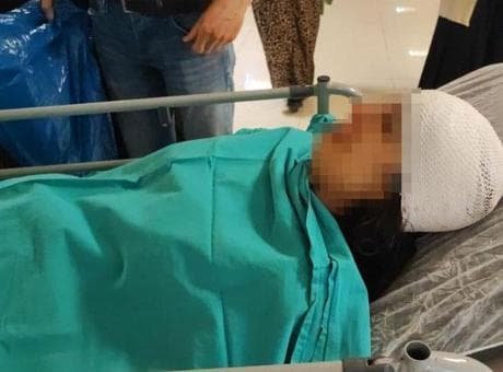 Ekmek almaya giden genç kız dehşeti yaşadı! 3'ü birden saldırdı: ‘Kafasında 20 santimlik bir açık var’