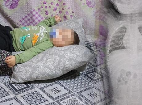 Bebeğin içinde ilerliyordu! 1 yıl boyunca ağladı: Tomografide korkunç gerçek