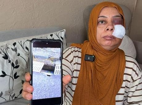 Elektrikli bisikletiyle rögara düştü! Dişleri kırıldı, yüzüne 14 dikiş atıldı