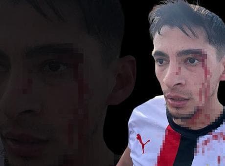 Amatör futbol maçında kavga çıktı, 3 futbolcu hastanelik oldu
