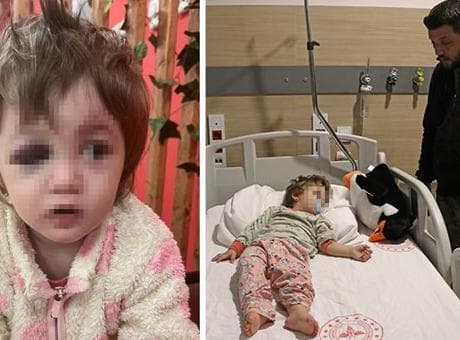 Yalova'da 14 aylık kızı ile birlikte darbedilen babadan yeni açıklama