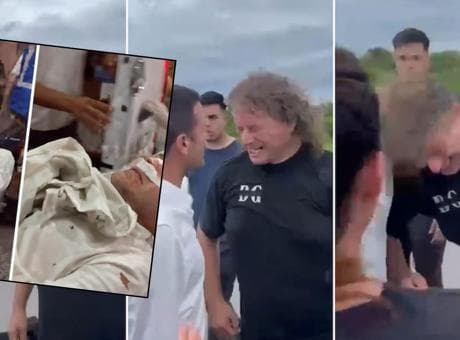 Milletvekiline şok saldırı! Kafa darbesiyle burnu kırıldı: İşte o görüntüler...
