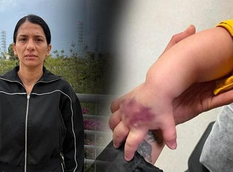 1,5 yaşındaki bebek tomografiyi alındı, kabus başladı: Çocuğumun kolu dirseğe kadar açıldı