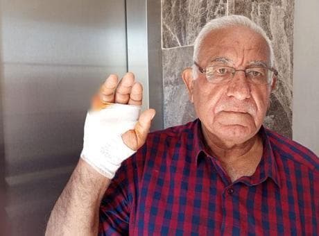 Asansörde korkunç saldırı! Komşu parmağını ısırarak kopardı: Onu çok severdim, niçin yaptı anlamadım