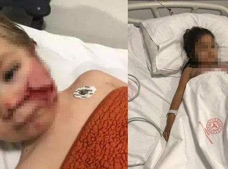 2 kardeşe saldırıp yaralayan pitbullun sahibi hakkında karar! 'Çocuğumu mahvettiler'