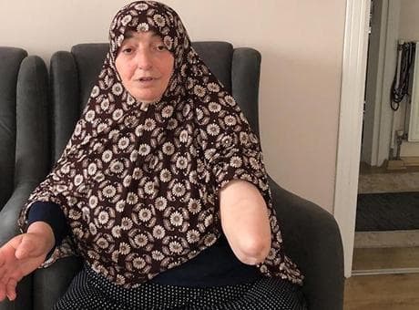 3 köpeğin saldırısına uğradı, acı haber geldi: Kolunu kurtarmak için karnına gömdüler