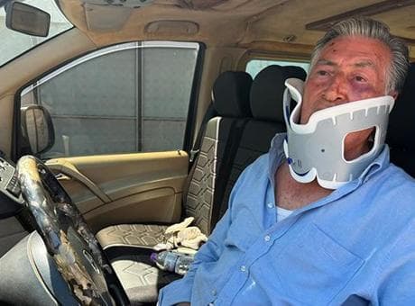 Antalya'da tur şoförü Litvanyalı boksör tarafından hastanelik edildi: 'Telefonu şarja koymadın diye yumrukladı'