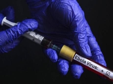 Fransa’da Ebola alarmı! 21 günlük karantina süreci başladı