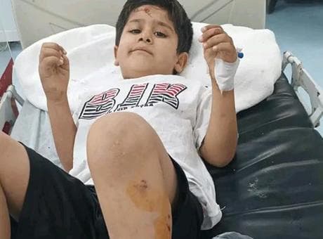 Şanlıurfa'da başıboş köpek saldırısı! Bakanlık inceleme başlattı