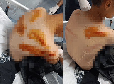 Şanlıurfa'da komşu dehşeti! 11 yaşındaki çocuğu sokak ortasında sopayla öldüresiye darbetti
