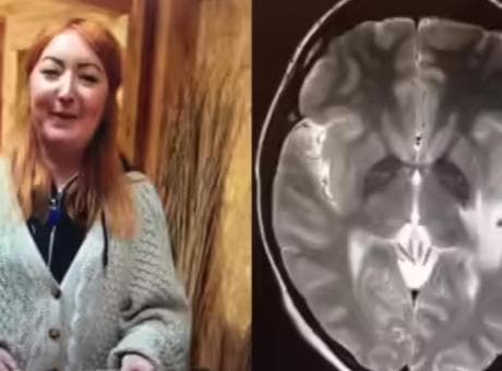 Hindistan gezisi sonrası kabusu yaşadı! Beyninde 38 adet tespit edildi