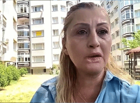 Dolgu yaptırdığı dudağı çürüdü! 'Gülüşüm yok, yemek yemem problem'