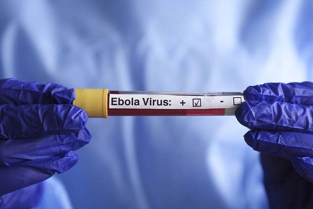 Fransa’da Ebola alarmı: İlk vaka tespit edildi