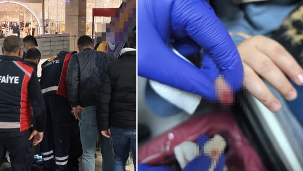 AVM'de korkunç olay! Yürüyen merdivene eli sıkışan 3 yaşındaki çocuğun parmağı koptu