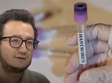 Prof. Dr. Oytun Erbaş'tan korkutan 'Hantavirüs' açıklaması: Belli gen grubunu öldürüyor, kendi suyunda boğuluyorsun